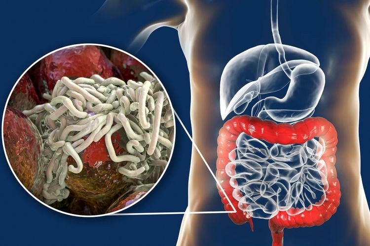 Pakar: Kematian Balita karena Cacingan Harus Jadi Alarm Perbaikan Sanitasi dan Gizi